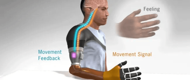 3D Printed Prosthetic Limbs Controlled by sEMG Sensors